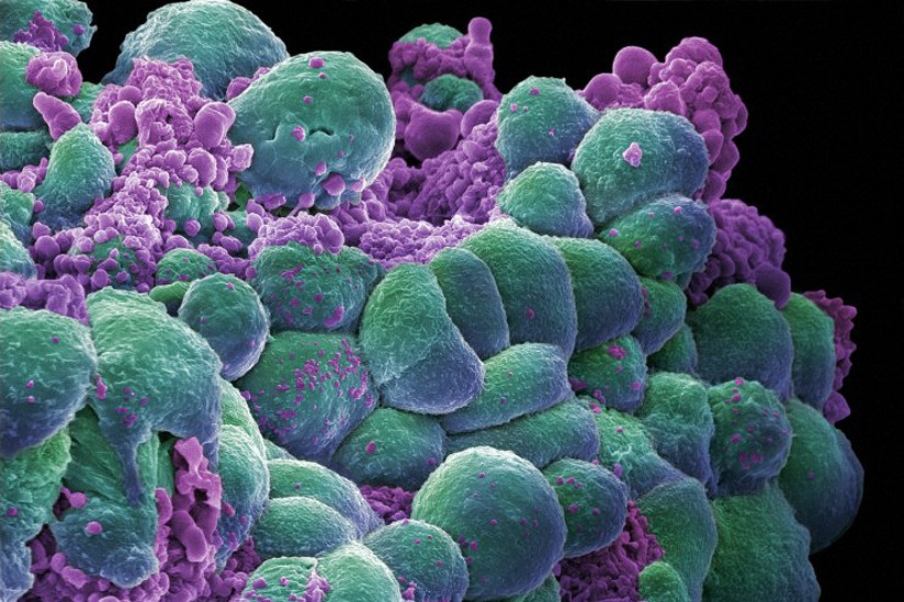 cancer therapy.jpg
